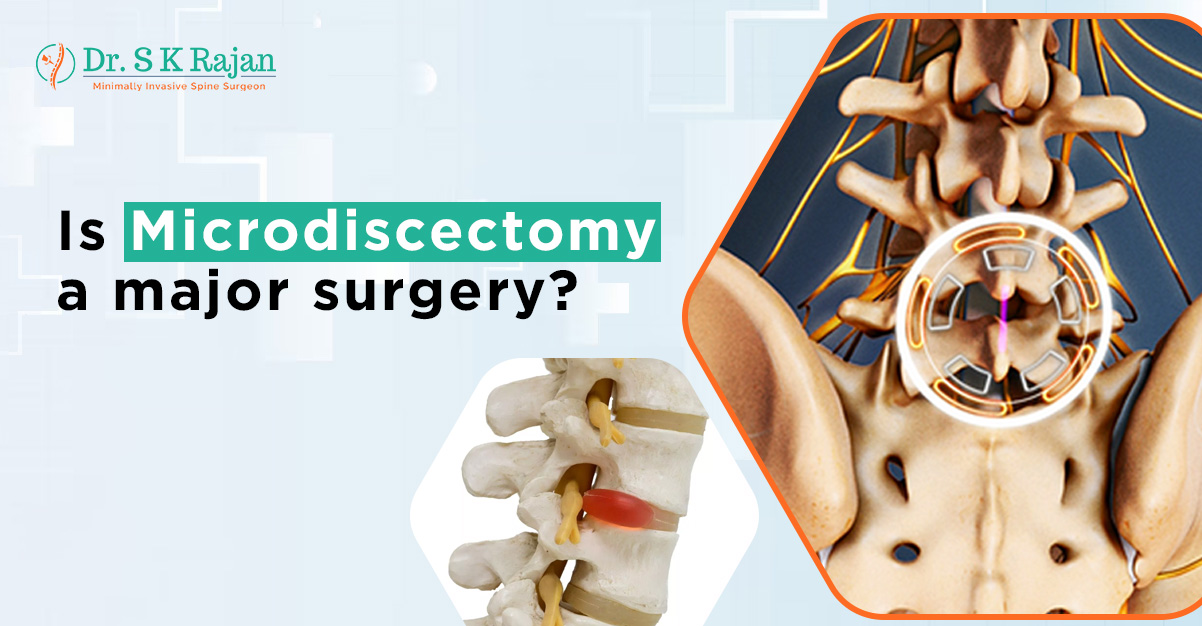 Is Microdiscectomy a major surgery
